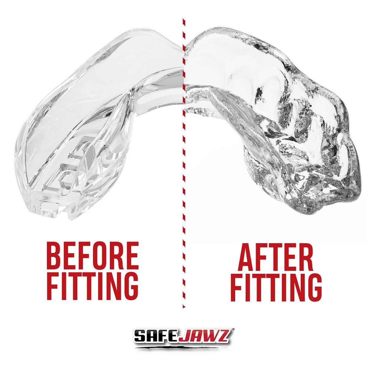 SafeJawz Intro Series Clear Mouthguard - Front