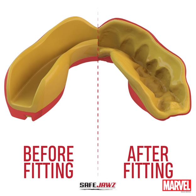 SafeJawz Marvel Iron-Man Mouthguard Refit