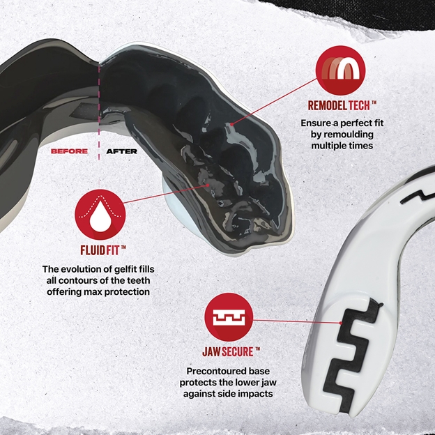 SafejawzMASTER-Mo-Mouthguard - Fitting.jpg