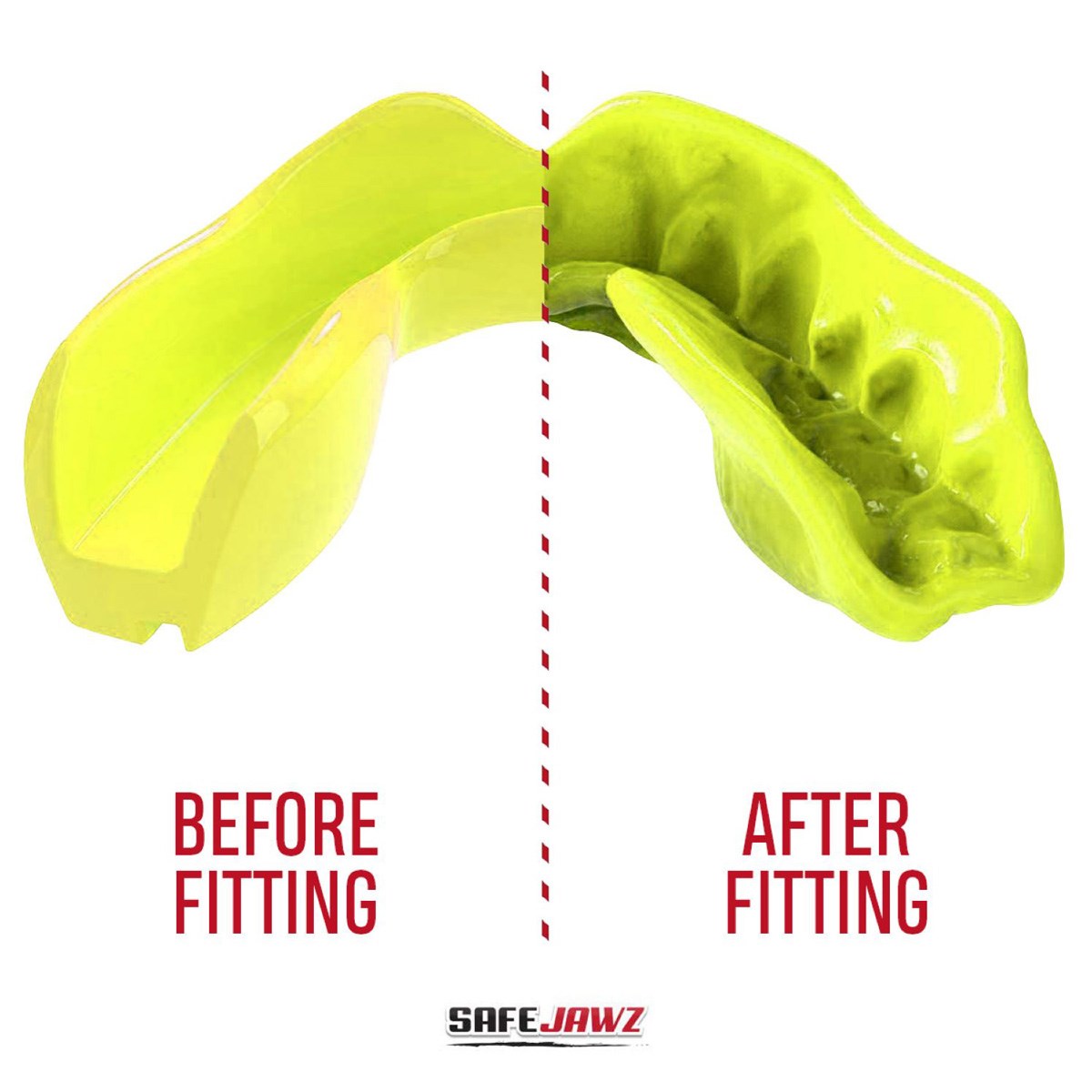 SafeJawz Intro Series Fluro Yellow Mouthguard, view 2