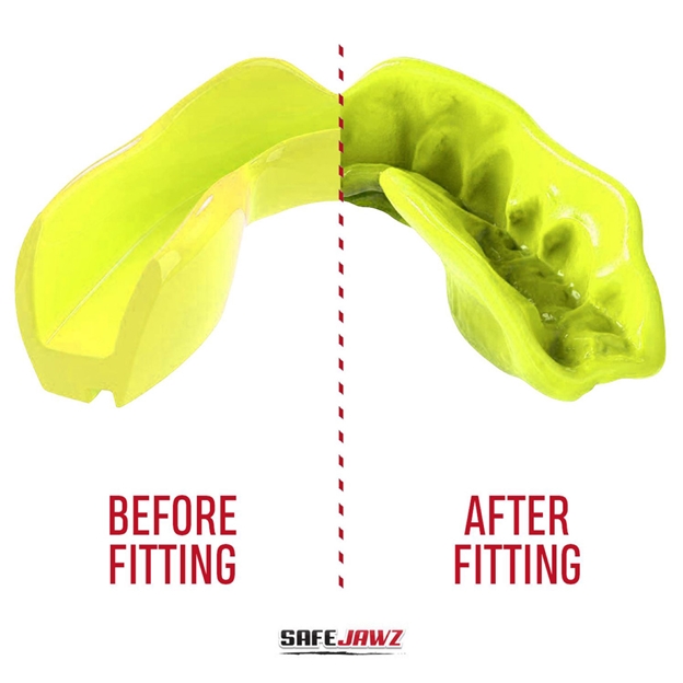 SafeJawz Intro Series Fluro Yellow Mouthguard - Bite
